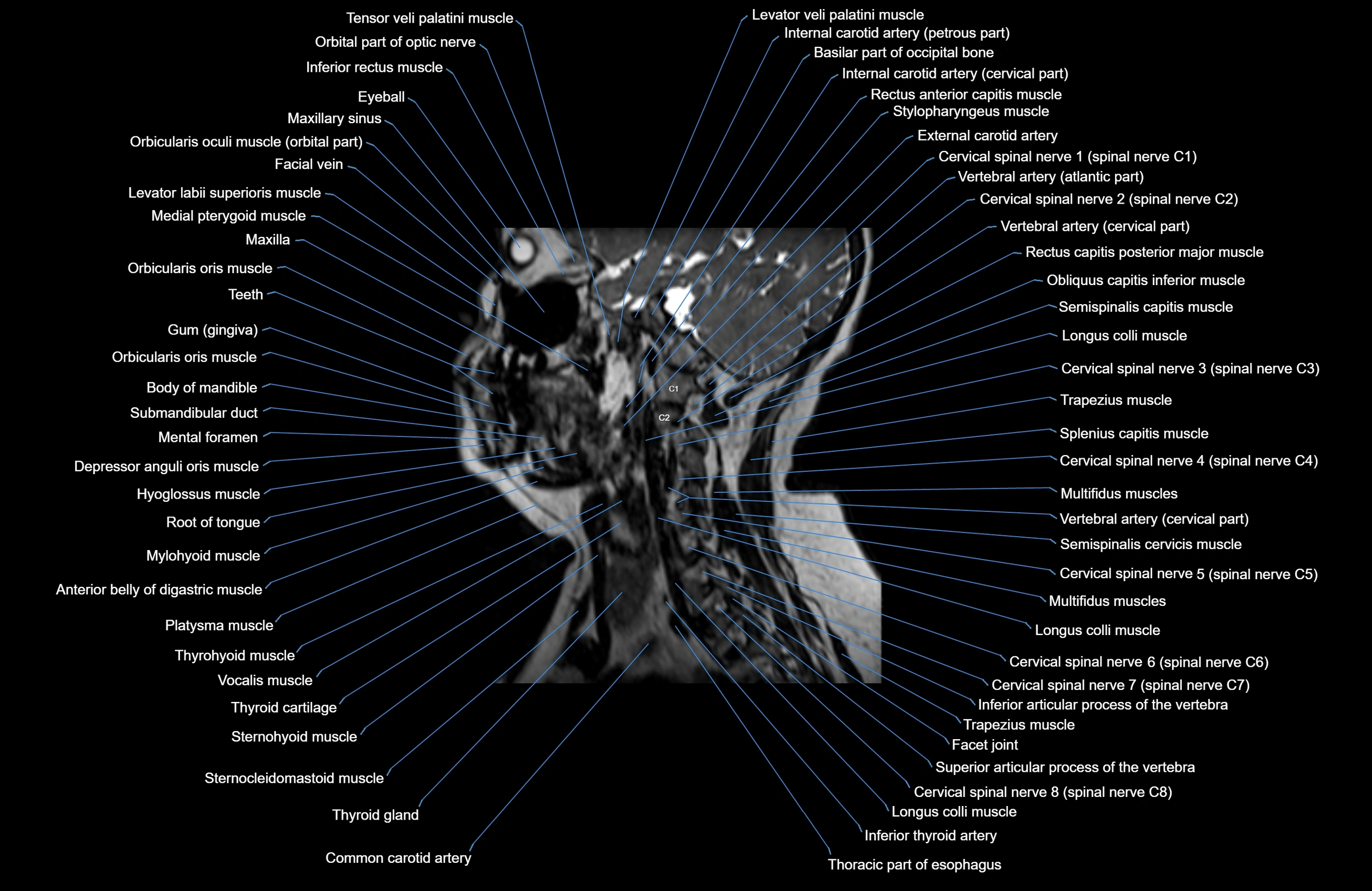 Neck MRI sagittal cross sectional anatomy 3D 1mm 3T radiology  image-img-00001-00014.webp